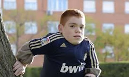 Acceso efectivo al tratamiento principal necesidad de los pacientes con Síndrome de Morquio