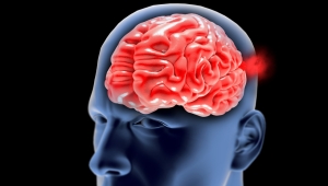 Especialistas se actualizan en amiloidosis hereditaria por transtiretina y polineuropatía en el Congreso de la Academia Mexicana de Neurología