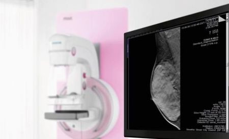Tecnología 3D de Siemens Healthineers mejora hasta en un 28% la detección temprana del cáncer de mama