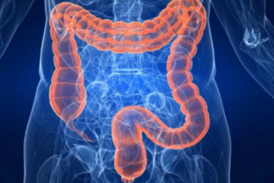 OPINIÓN :: Síndrome de Intestino Irritable
