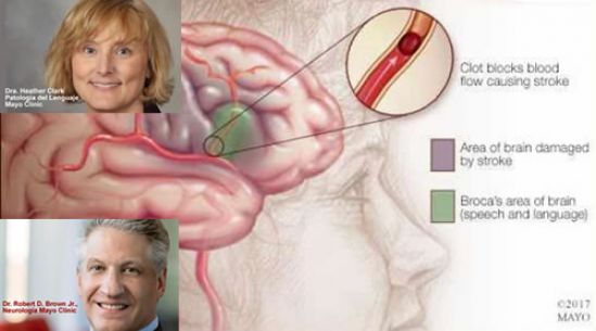 Terapia del lenguaje, una opción para los afectados por un accidente cerebrovascular