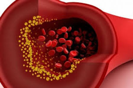 AMGEN presenta resultados de seguridad y eficacia a largo plazo de evolocumab, en el estudio más largo hasta la fecha de un inhibidor de PCSK9
