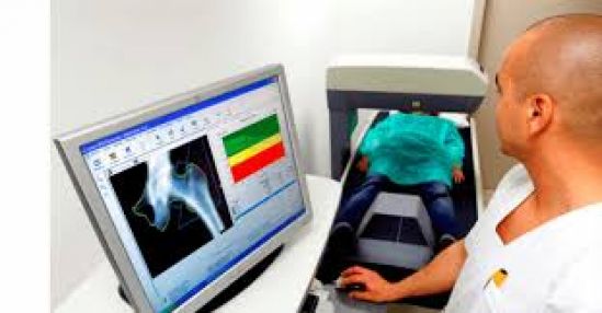 Densitometría ósea determina riesgo de fracturas y osteoporosis