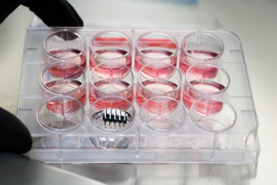 Electroquimioterapia, método para la administración específica de fármacos orientados a combatir las neoplasias en mamas