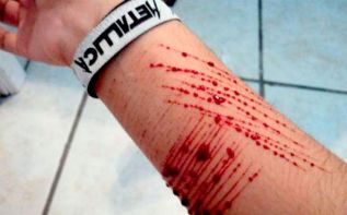 El cutting, una antesala del suicidio en niñas y adolescentes