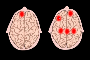 Analizan investigadores la percepción cerebral del arte