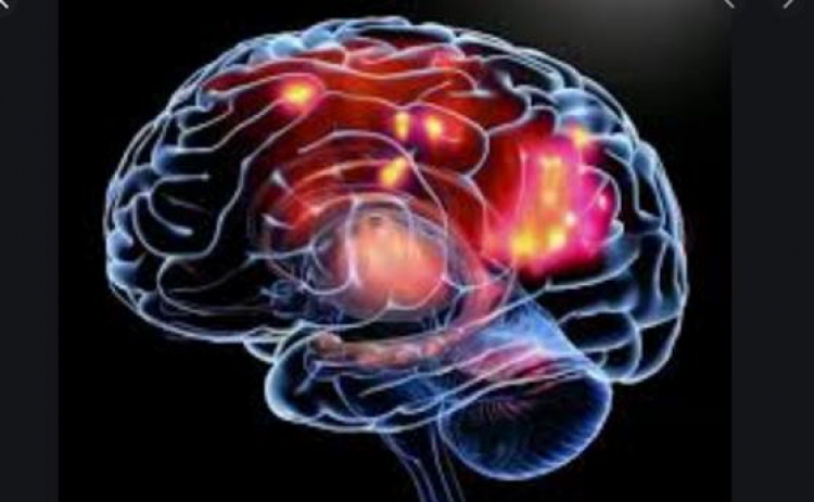 ¿Cómo reaccionar ante una crisis convulsiva?