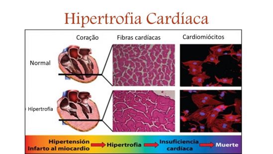 Investigadores del Cinvestav analizan efectos de sacarosa y fructuosa en desarrollo de hipertrofia cardíaca