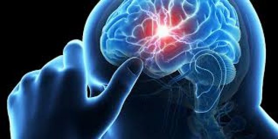 Cada segundo, pacientes pierden más de 33 mil neuronas por infarto cerebral