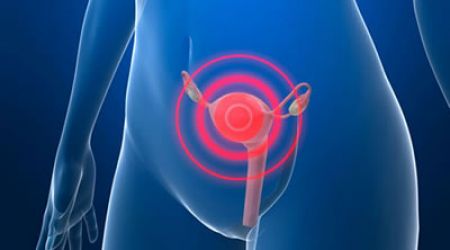 Especialistas buscan disminuir el impacto del Cáncer Cervicouterino en la población mexicana