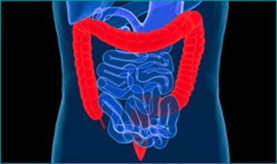 Colonoscopía y su rol en la detección temprana del cáncer colorrectal