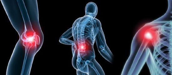 Osteoartritis es considerada problema de salud pública, es la más común de las enfermedades reumáticas crónicas