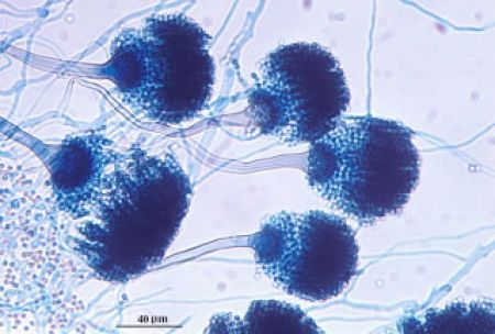 En México, al menos 50% de las infecciones fúngicas invasivas no se diagnostican