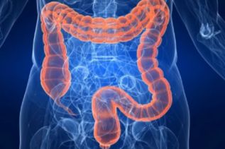 Tres de cada cuatro pacientes con intestino irritable padece síntomas durante al menos cinco años