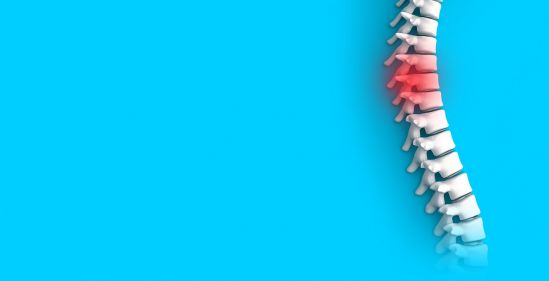 Tumores espinales: un enemigo silencioso y peligroso